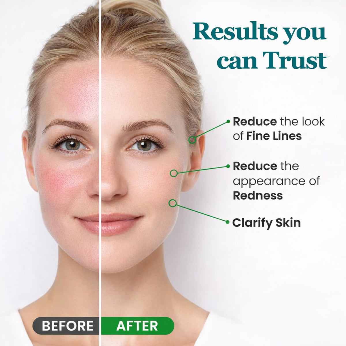 Peehss application under eye demo showing targeted nourishment benefit