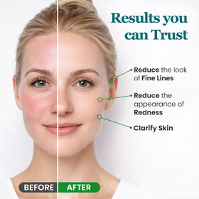 Peehss application under eye demo showing targeted nourishment benefit