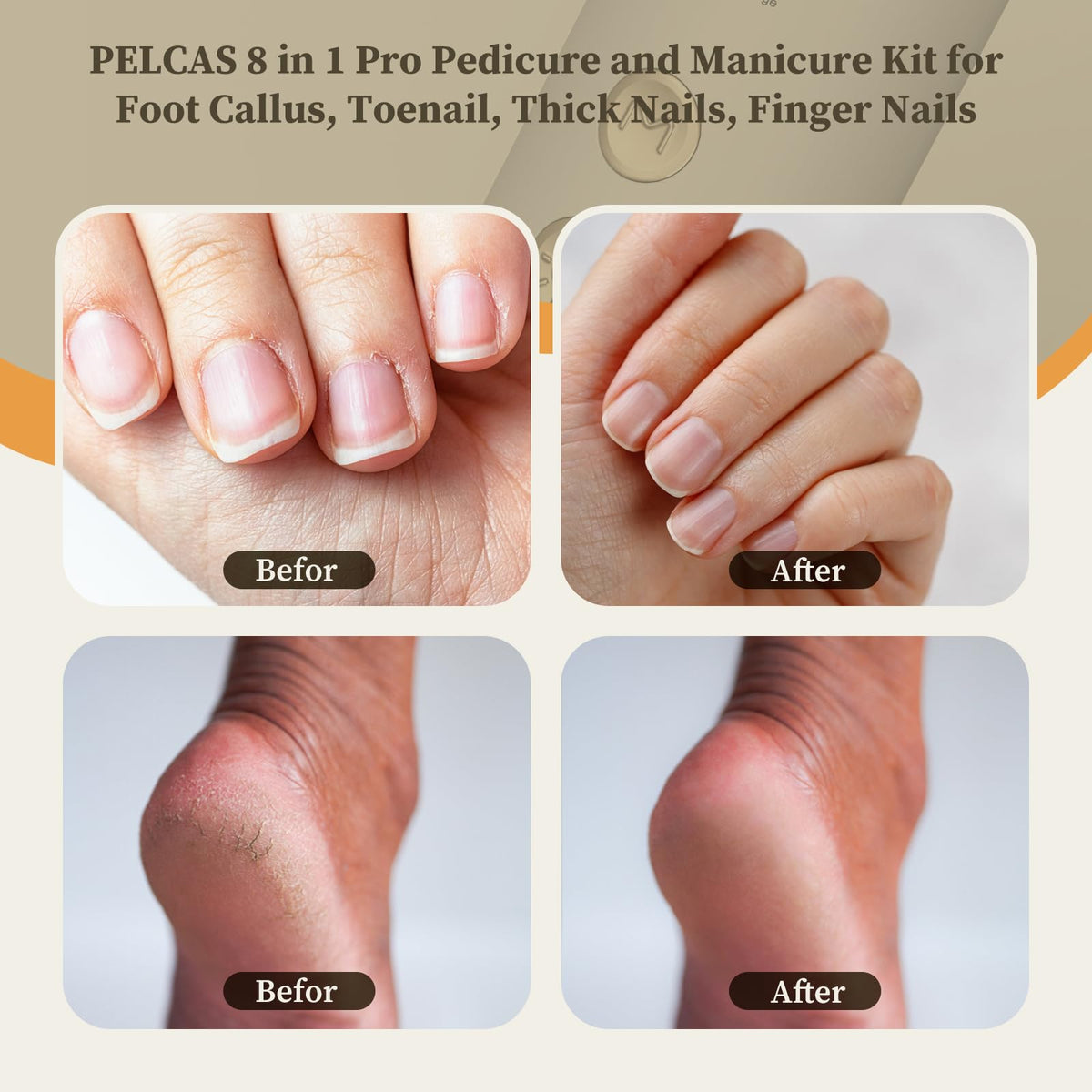 PELCAS pen-shaped drill detail highlighting ergonomic grip for precise control