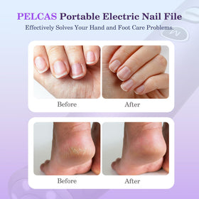 PELCAS close-up of pen-style body highlighting ergonomic grip and control