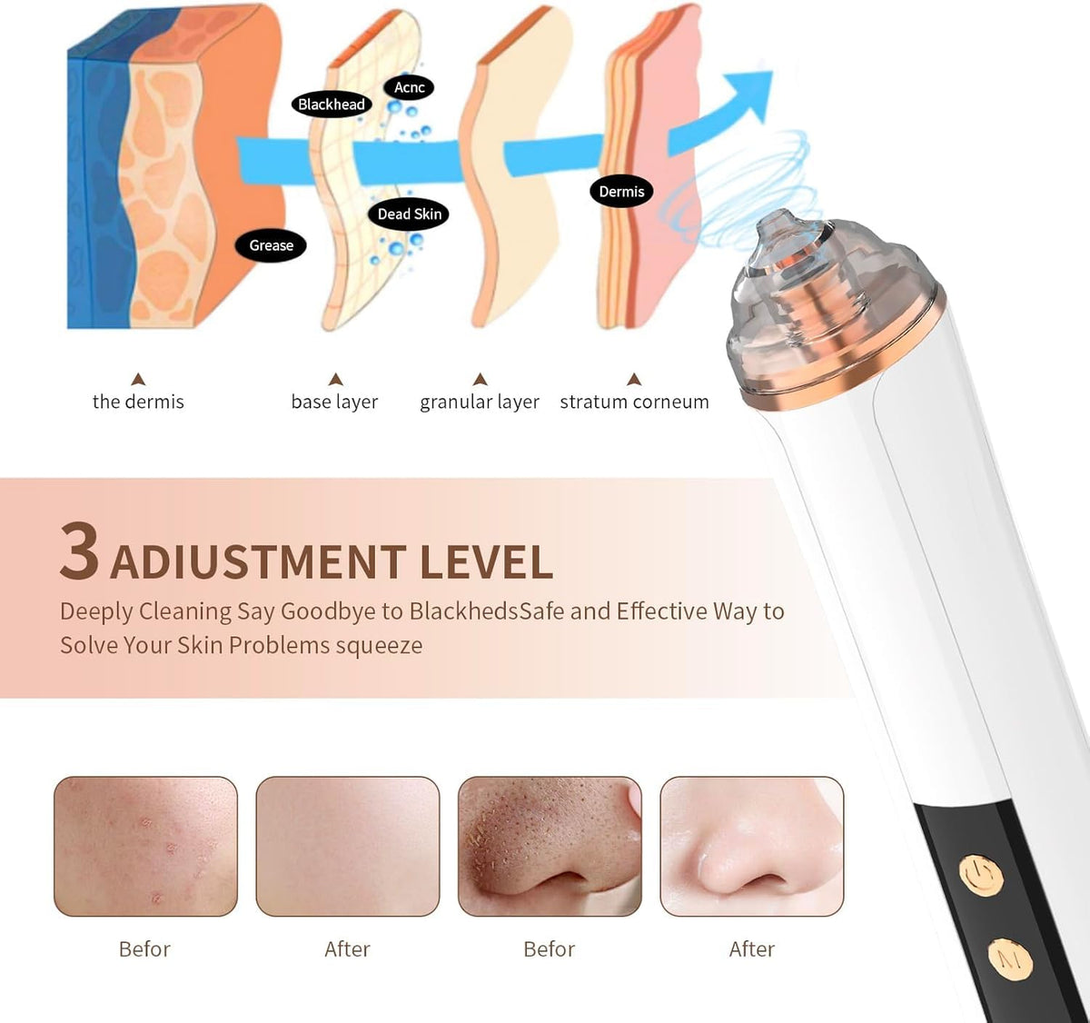 PENSVOX device held in hand to show compact size and travel-friendly benefit