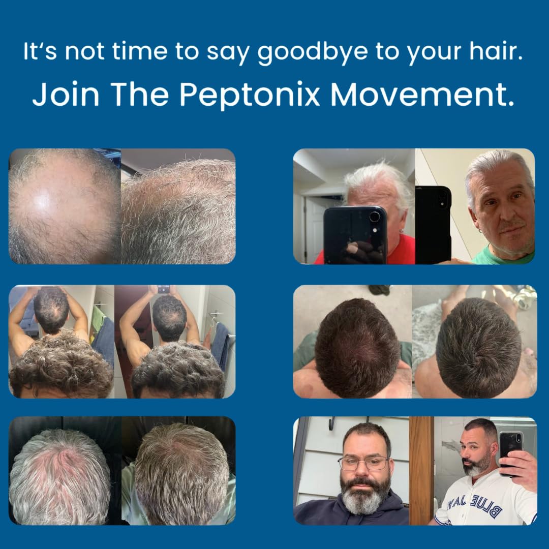 Peptonix being applied to scalp with fingertip, demonstrates targeted nourishment benefit