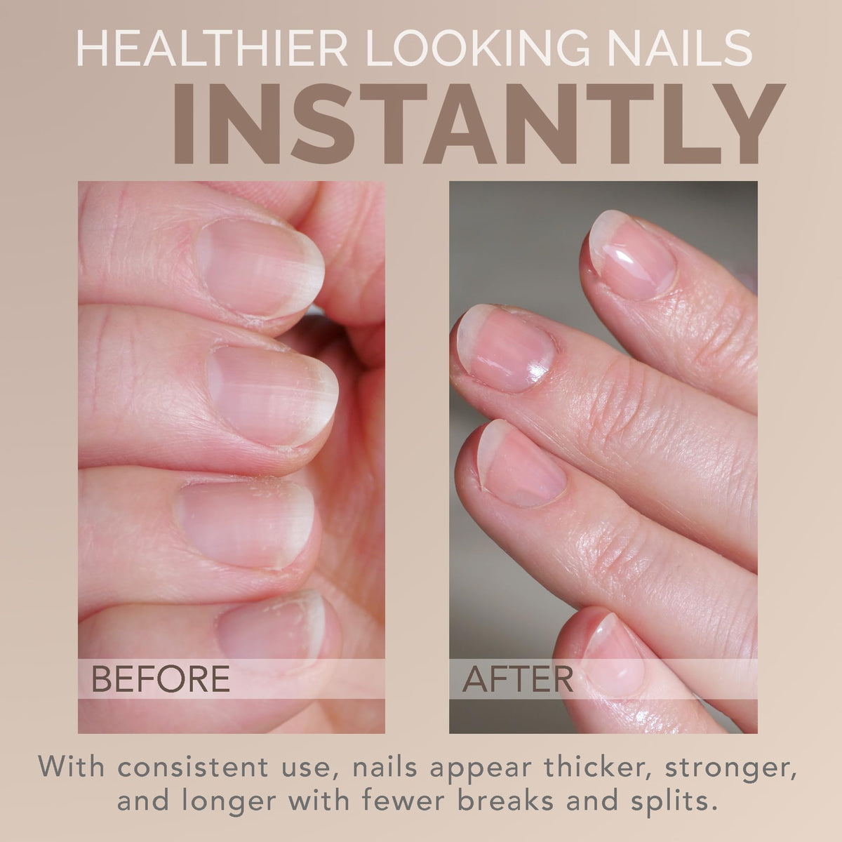 Perfect Formula applied on hands in lifestyle setting for polished nails