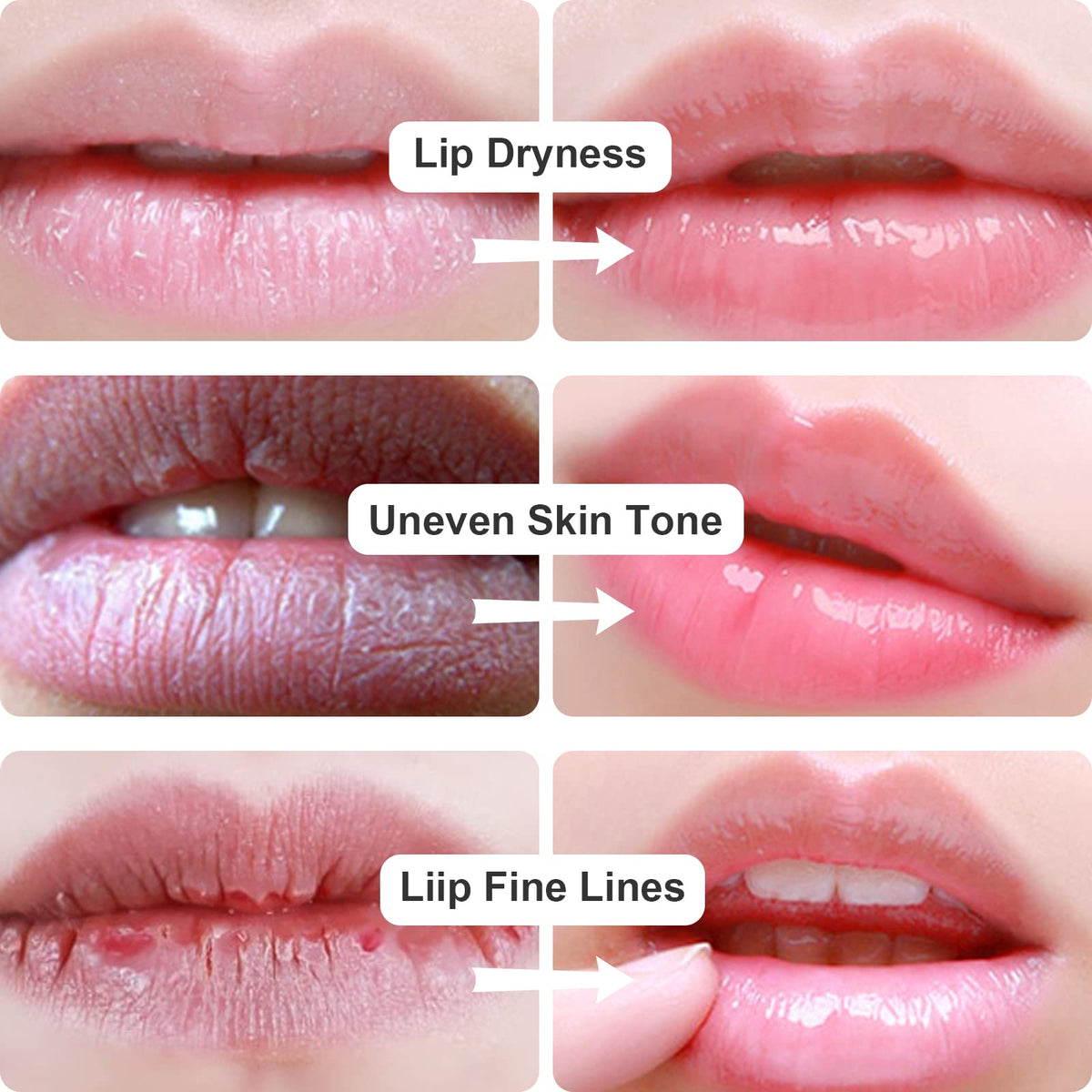 Permotary lip mask being worn illustrating hydrating in-use comfort