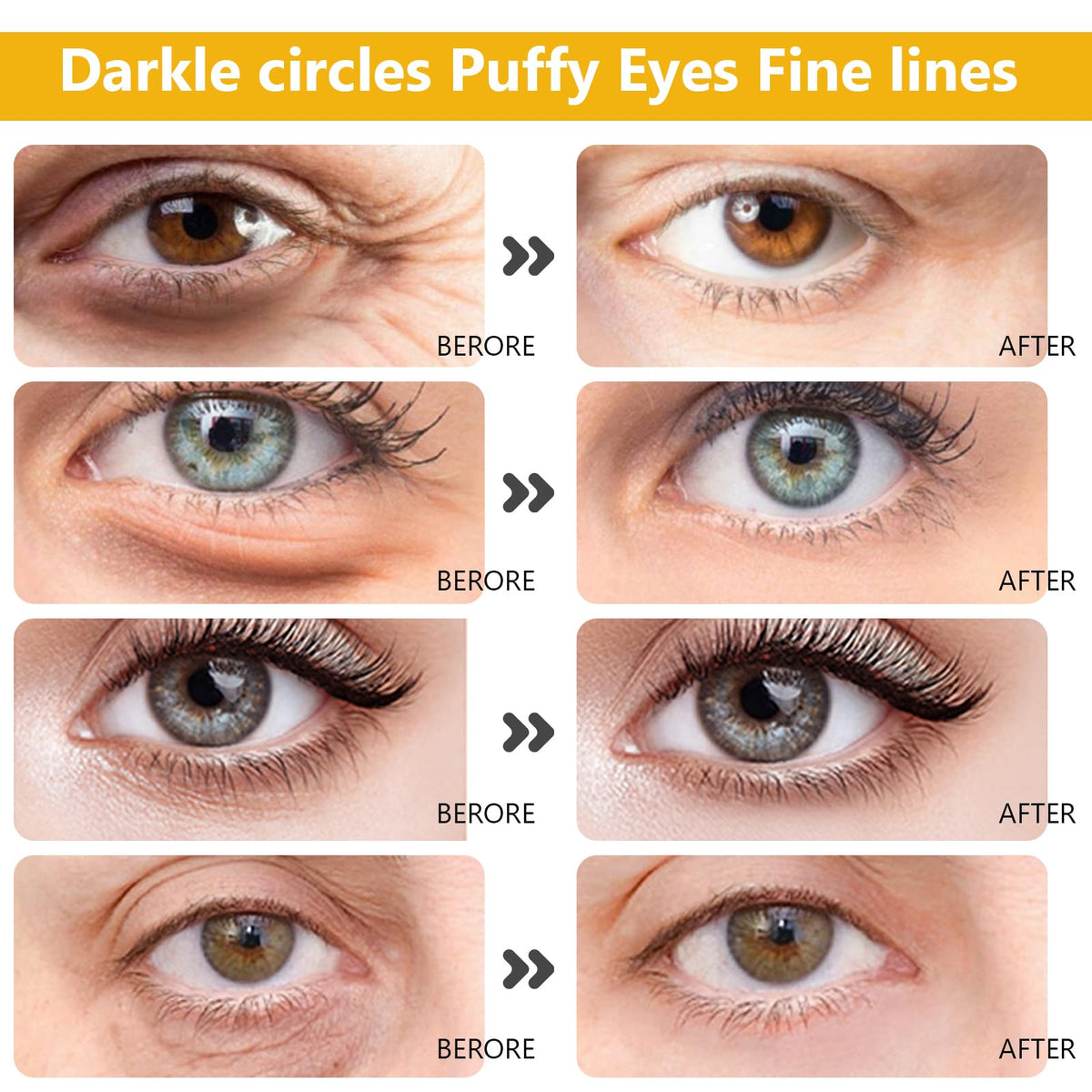 Permotary under-eye patches worn under eyes to reduce puffiness appearance and soothe skin