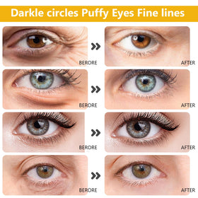 Permotary under-eye patches worn under eyes to reduce puffiness appearance and soothe skin