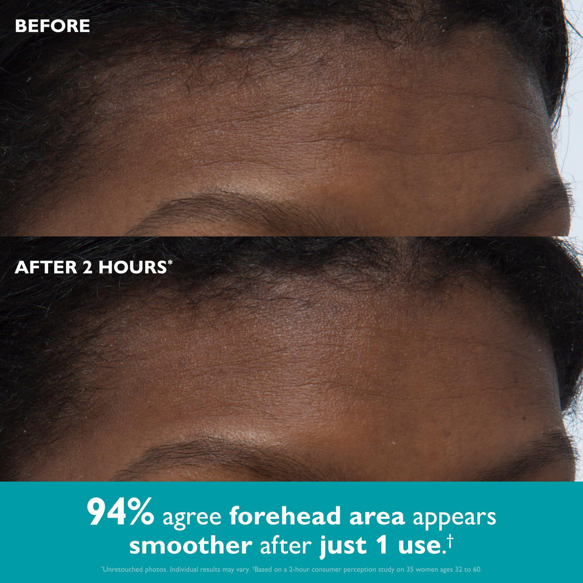 Peter Thomas Roth tape applied to forehead demonstrating smoothing benefit