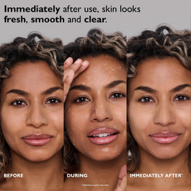 Peter Thomas Roth gel texture close-up revealing gentle beading action