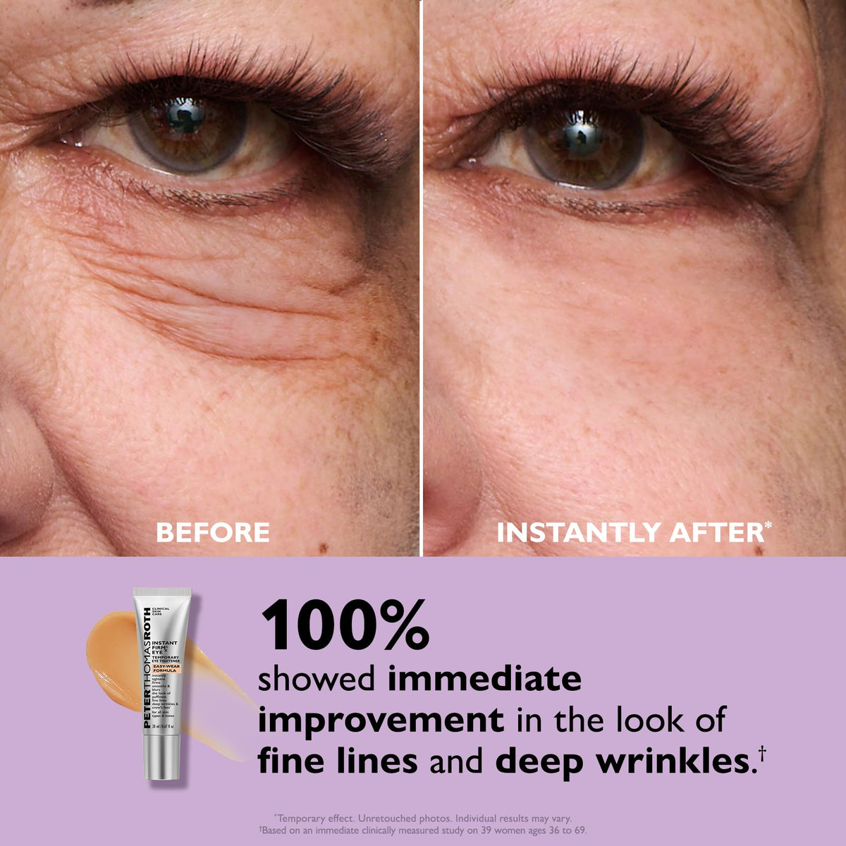 Peter Thomas Roth applicator detail demonstrating precise application