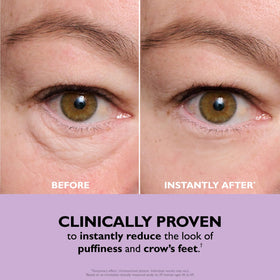 Peter Thomas Roth before and after eye close-up showing visible tightening effect