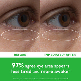 Peter Thomas Roth open jar with hydrated gel eye patches visible inside