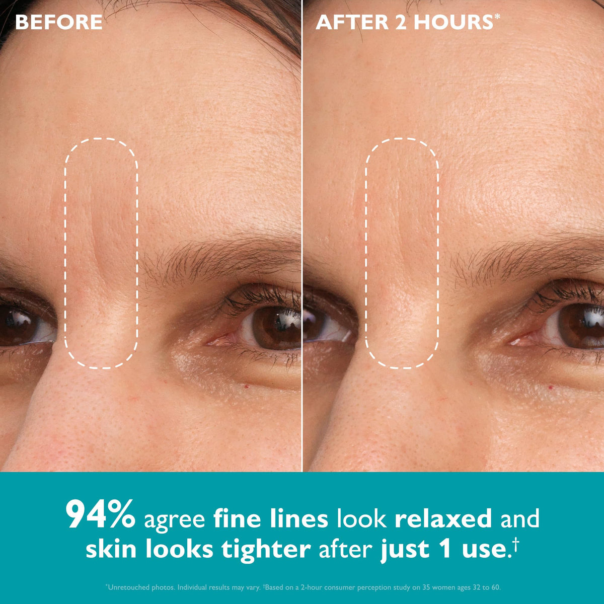 Peter Thomas Roth close-up of oval tape texture and adhesive benefit
