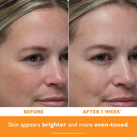 Peter Thomas Roth dropper dispensing serum showing precise application control