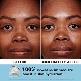 Peter Thomas Roth jar and patches side-by-side showing product scale