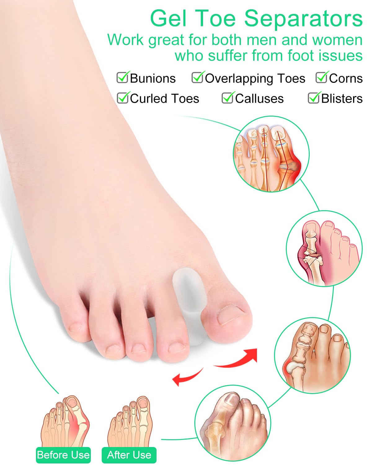 PGRODE spacer worn inside shoe and sock for secure daily wear