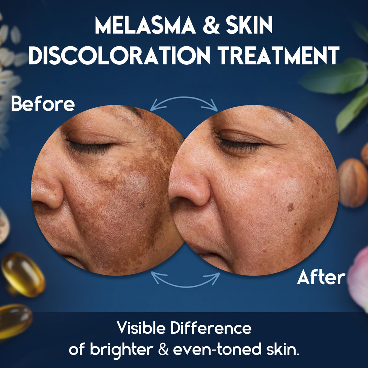 Pharmlitalia applied to cheek showing targeted coverage of dark spots