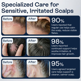Pharmlitalia conceptual before-after flake reduction visualization benefit