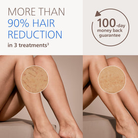 Philips Lumea close-up of SenseIQ sensor, adapts settings for comfort