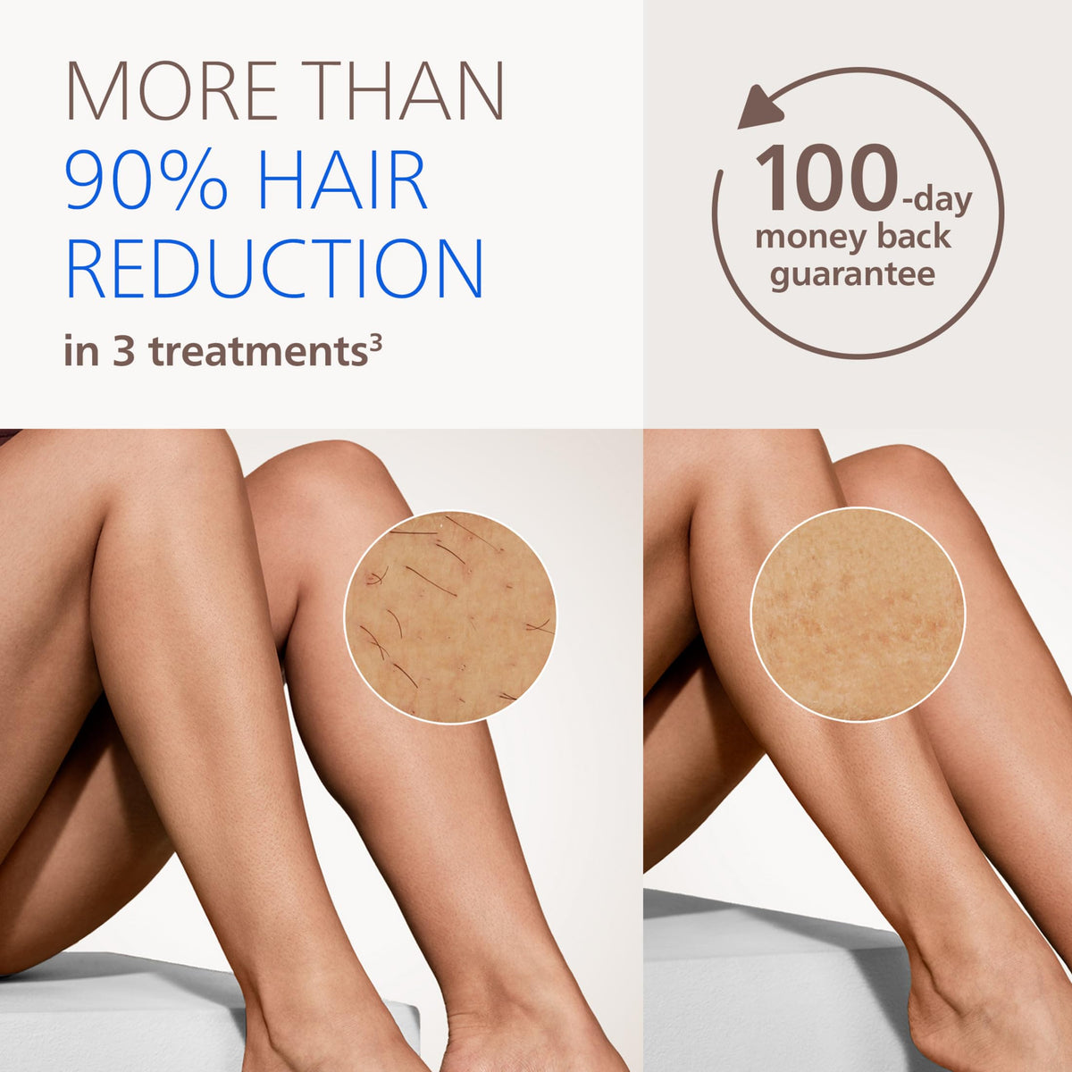 Philips Lumea flash window close-up highlighting the SmartPulse lamp for precise light delivery