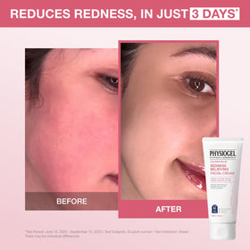 PHYSIOGEL cream texture close-up highlighting rich hydration benefit
