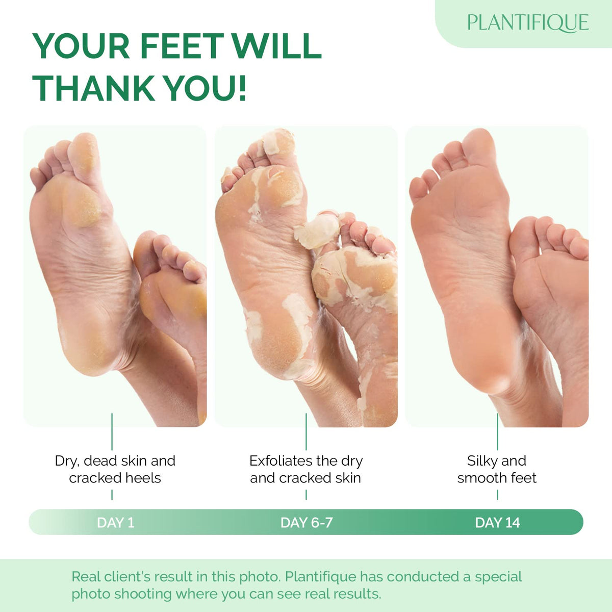 PLANTIFIQUE close-up of single-use bootie interior highlighting secure fit and comfort