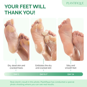PLANTIFIQUE close-up of single-use bootie interior highlighting secure fit and comfort