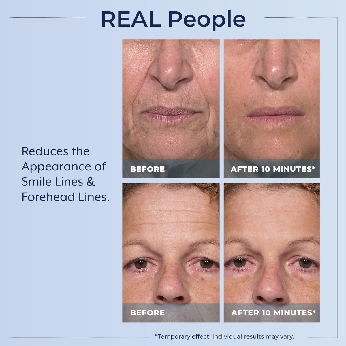 Plexaderm application under eye demonstration showing quick targeted lifting effect