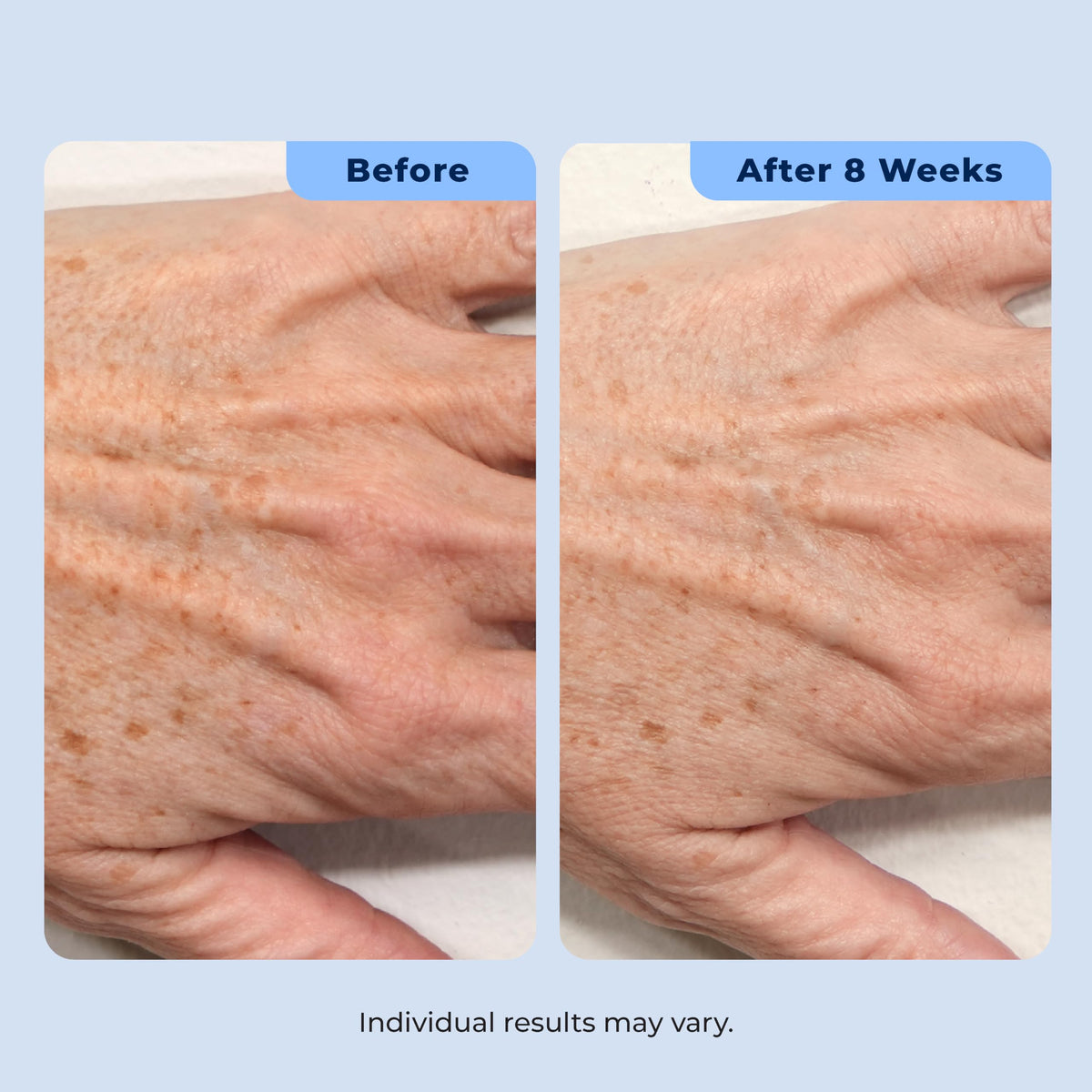 Plexaderm placed on bathroom vanity in lifestyle scene suggesting nightly skincare ritual