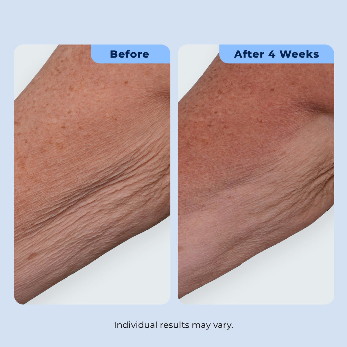 Plexaderm ingredient callout showing retinol and bakuchiol for combined anti-aging support