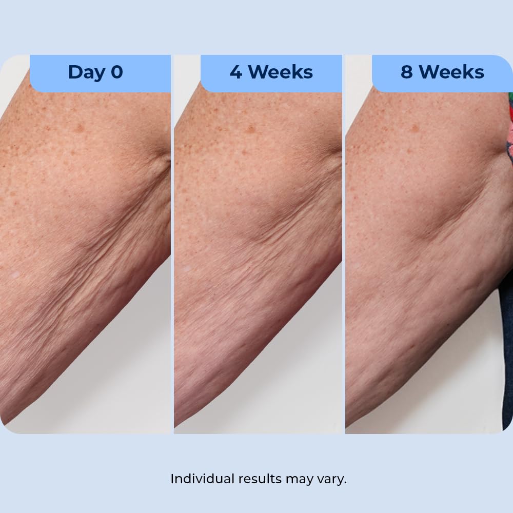 Plexaderm pump dispensing cream onto fingers for precise neck and décolletage application