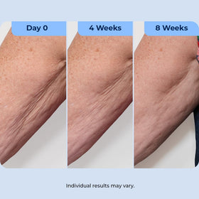 Plexaderm pump dispensing cream onto fingers for precise neck and décolletage application