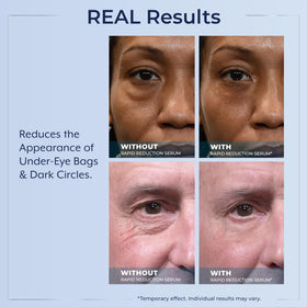 Plexaderm satin finish detail on skin showing natural-looking smoothing benefit