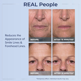 Plexaderm dried satin finish on skin demonstrating natural youthful glow