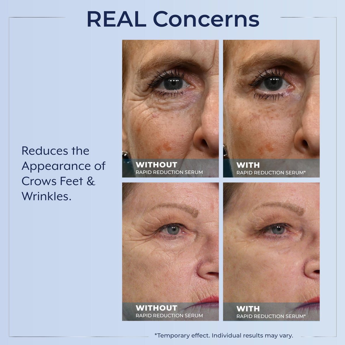 Plexaderm pod beside fingertip to show compact size and travel-friendly benefit