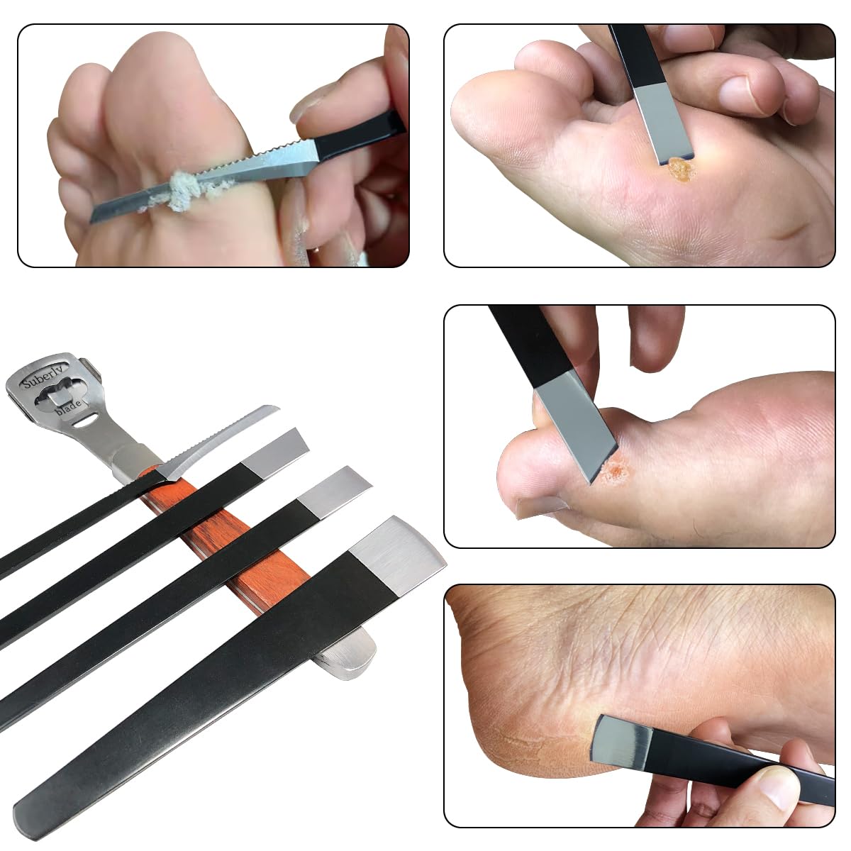 POQOD tool in use smoothing a heel showing effective callus control