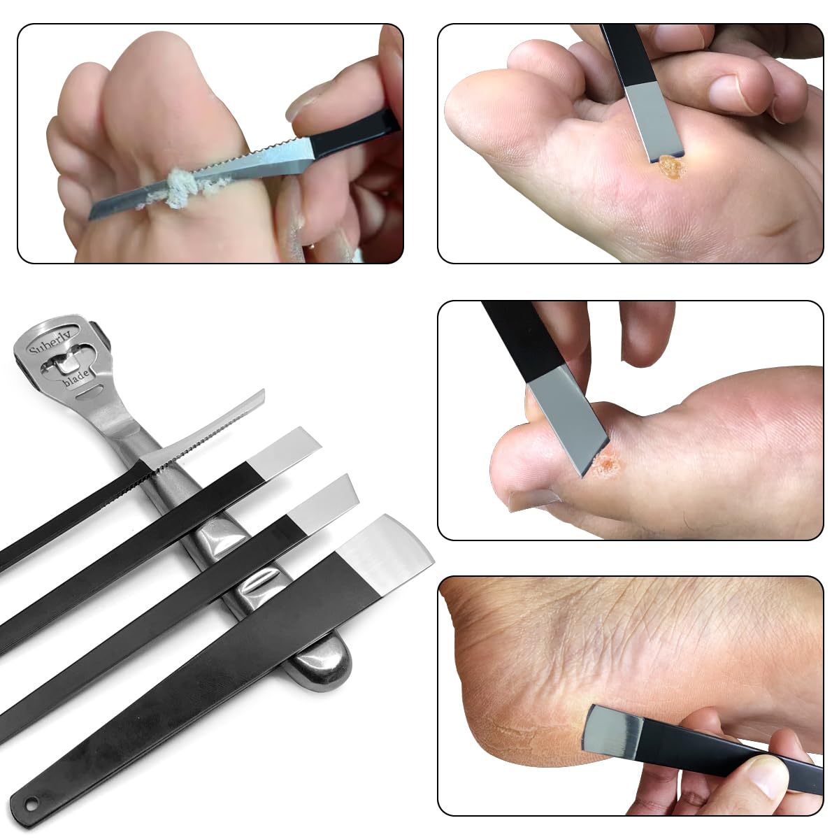 POQOD tool being used on soaked foot to show safer, gentler callus reduction benefit