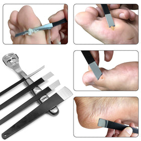 POQOD tool being used on soaked foot to show safer, gentler callus reduction benefit