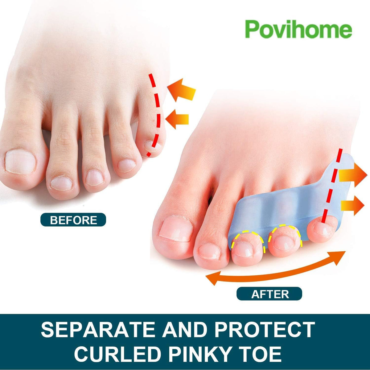 Povihome separator in use inside shoe reducing toe friction