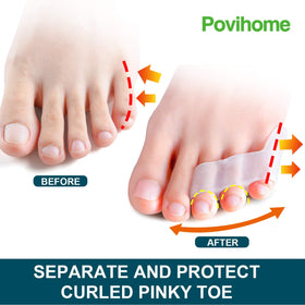 Povihome toe spacers worn under a sock showing comfortable fit