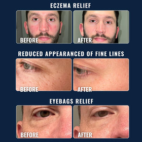 Prettyboy applied after shaving calming skin and reducing visible redness