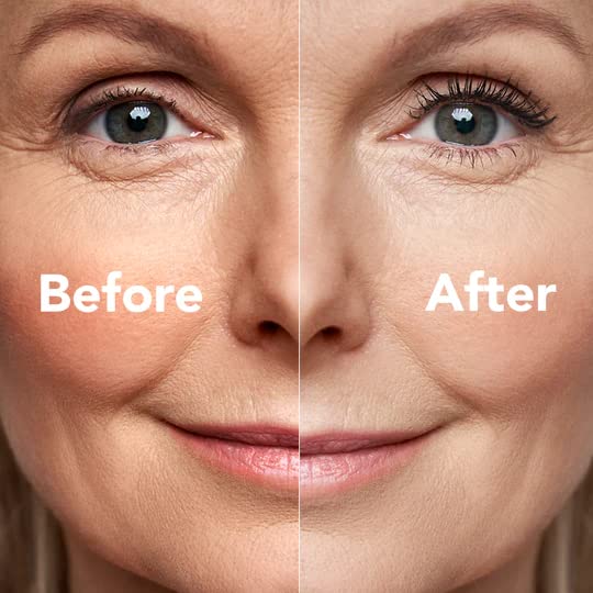 PRIME PROMETICS before and after lashes showing fuller, lifted results