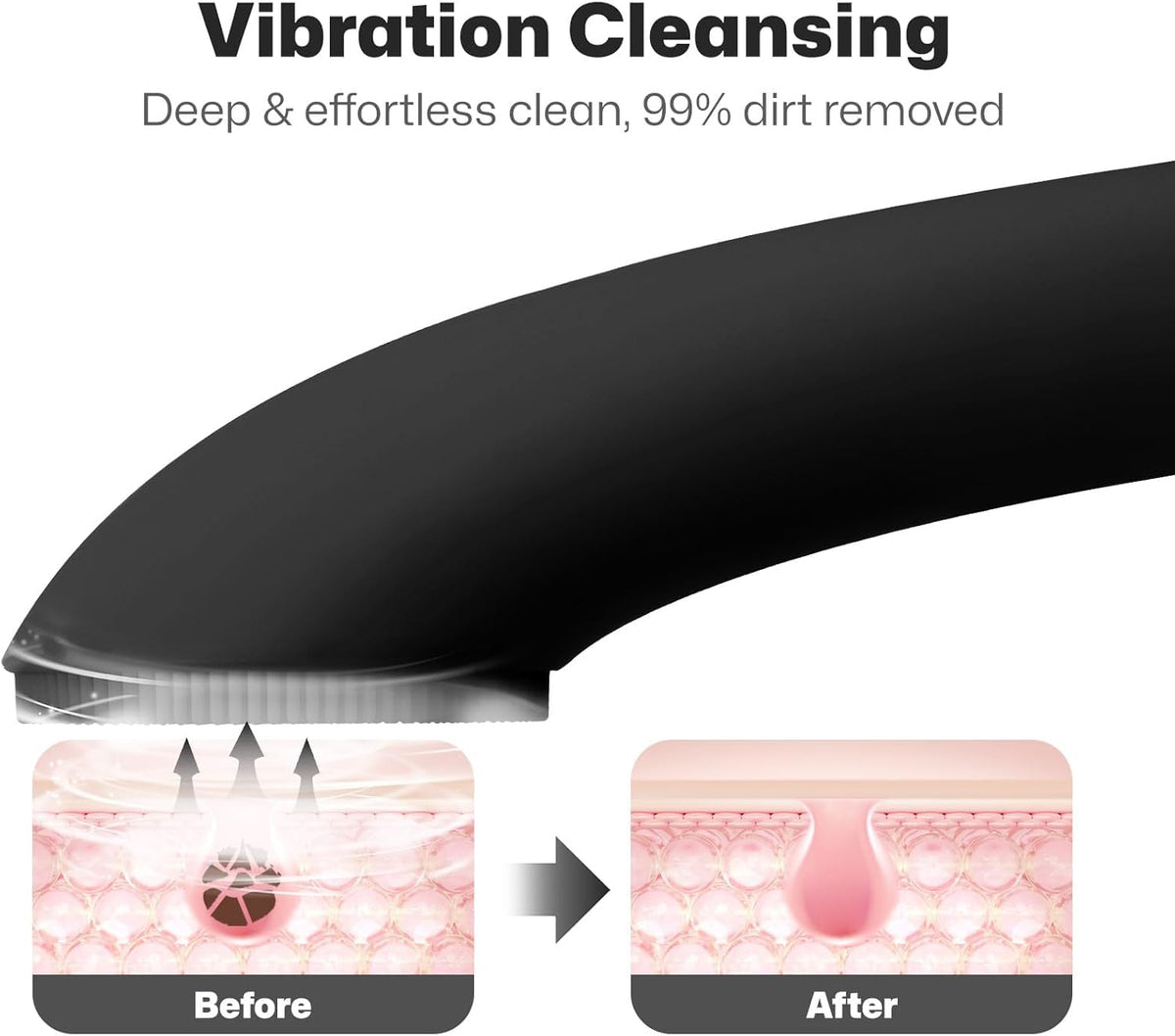 PRITECH close-up of ultra-soft silicone bristles for gentle cleansing benefit