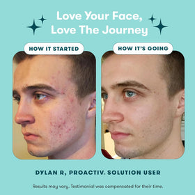 Proactiv pimple patch on skin demonstrating discreet protection and faster healing