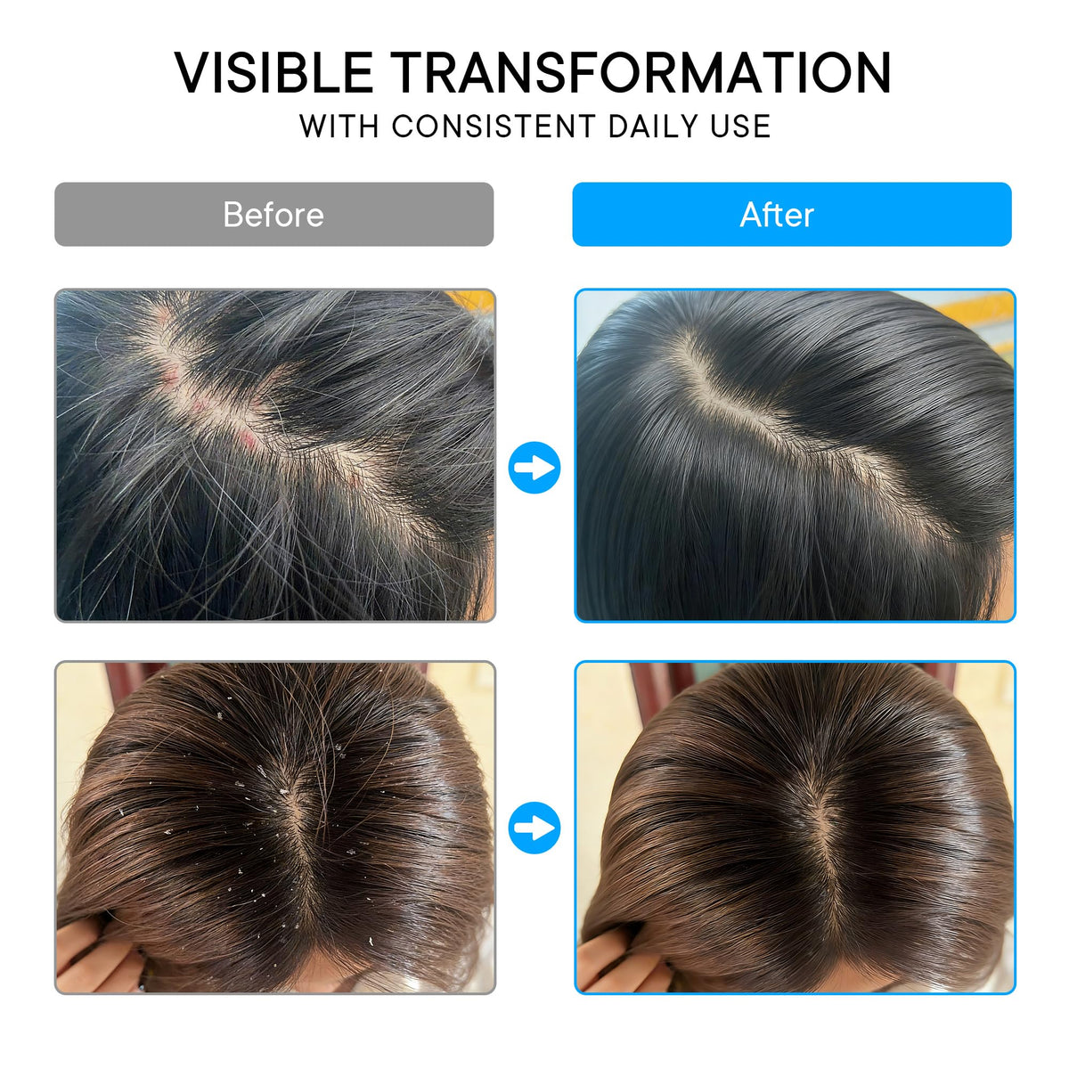 ProBliva label ingredient highlights showing 3% salicylic acid and gentle formulation