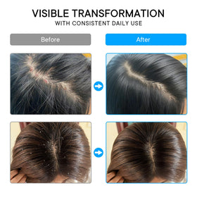 ProBliva label ingredient highlights showing 3% salicylic acid and gentle formulation