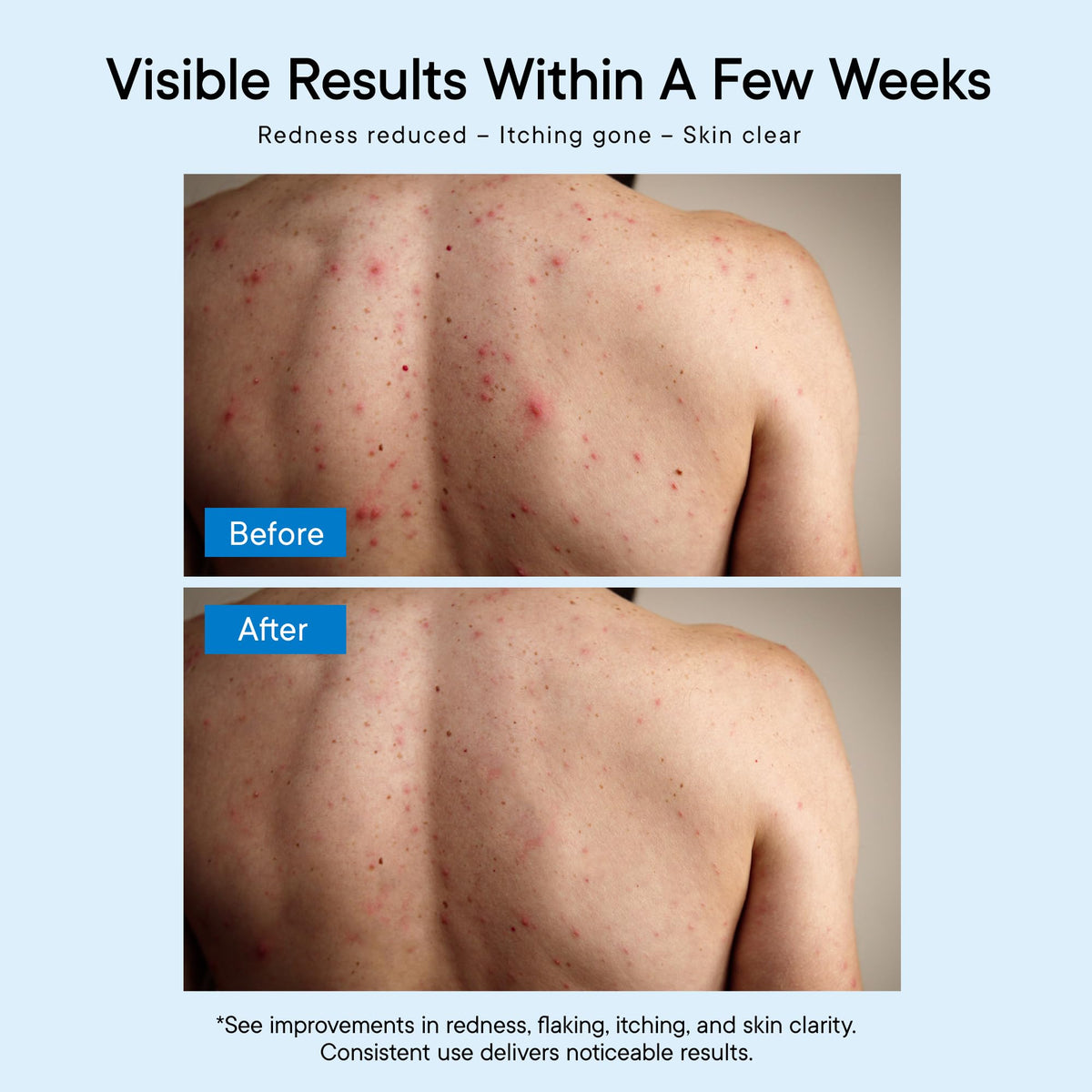 Person using ProBliva in shower after workout for odor control