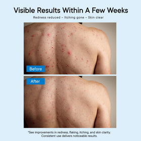 Person using ProBliva in shower after workout for odor control