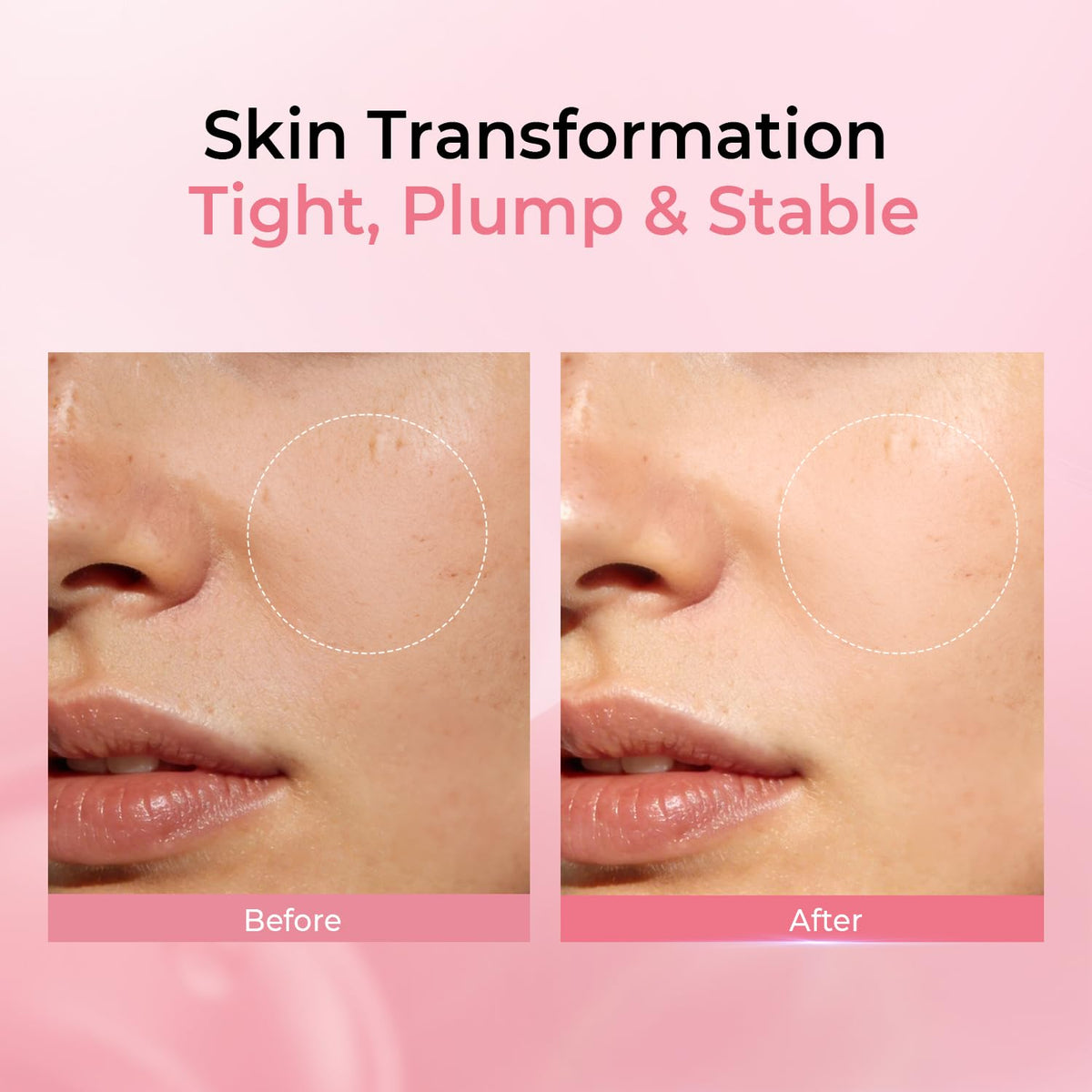 PROF.LING ingredients label showing hyaluronic tranexamic niacinamide clarity