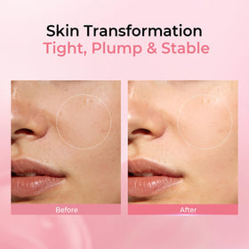 PROF.LING ingredients label showing hyaluronic tranexamic niacinamide clarity