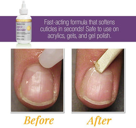 ProLinc applied to fingernail during at-home cuticle prep for faster results